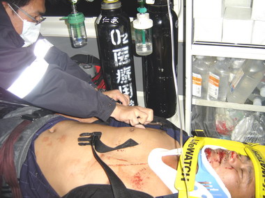 北山長壽橋發生酒駕車禍(圖)