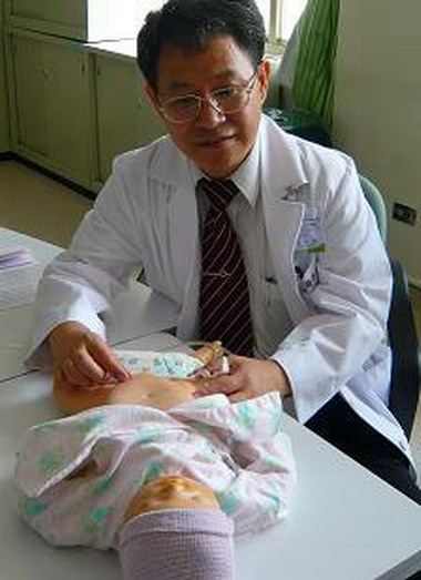 輸卵管卡進腹股溝疝氣(圖)