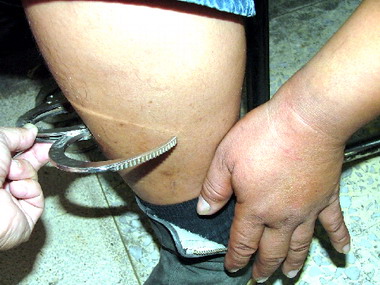 煙毒犯壯如牛手銬銬不住(圖)