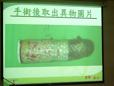 情趣按摩棒穿破直腸(圖)