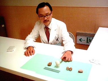 小小攝護腺 肥大問題大(圖)