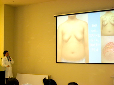 男性胸部突起可進行抽脂塑胸(圖)