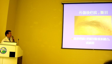 眉毛外傷植眉手術恢復自信(圖)