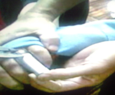 鋼戒套指痛難拔求助消防局解危機(圖)