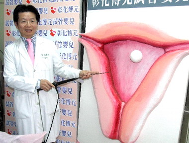 常做人工流產容易導致不孕(圖)