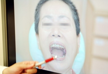 台中矯正牽引找回肌肉記憶創先例(圖)