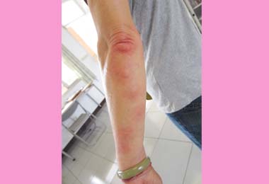 台中小黑蚊又開始肆虐師生苦不堪言(圖)