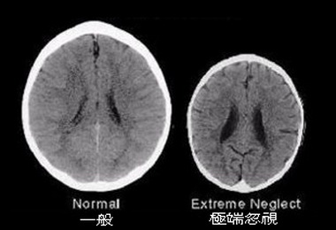 研究：母愛決定了孩子大腦的大小(圖)