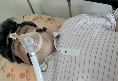 呼吸不順可能罹患匹克維克症候群(圖)