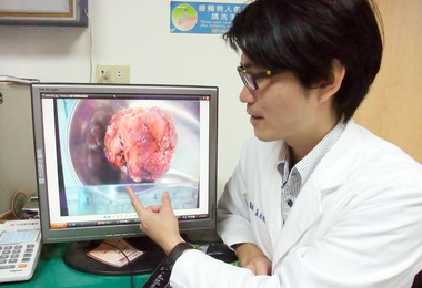 小卵巢瘤神隱一年後竟已脹大轉惡性(圖)