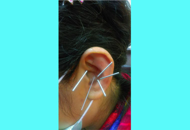 中醫調理預防二型糖尿病急性併發(圖)