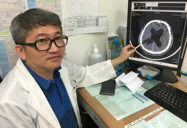 老年人好發水腦症 腦室腹腔分流可改善(圖)