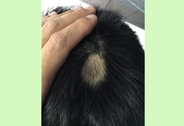 壓力大 年輕男子驚見鬼剃頭(圖)