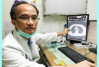 憋氣刷油漆胸痛 縱膈腔氣腫作祟(圖)