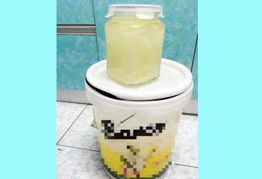 椰子油治百病？投醫：恐增血管風險(圖)