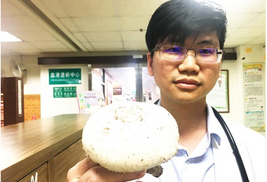 誤採毒菇煮上桌 全家中毒送醫(圖)