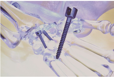 南台灣醫材聚落添火力 工研院3D列印醫材 南台灣發光(圖)