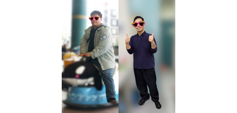 夫妻同心攜手甩肉50公斤！ 小港醫院透過「內視鏡袖狀胃成形術」助夫妻檔找回健康與自信(圖)